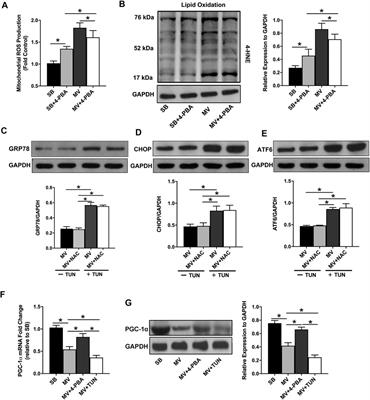 Endoplasmic Reticulum Stress Contributes to Ventilator-Induced Diaphragm Atrophy and Weakness in Rats